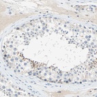 Immunohistochemical staining of human testis shows high expression.