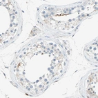 Immunohistochemical staining of human testis shows weak cytoplasmic positivity in Leydig cells.