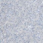 Anti-PCDHB2 Antibody