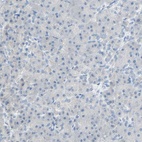 Immunohistochemical staining of human pancreas shows low expression as expected.