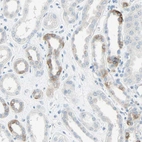 Immunohistochemical staining of human kidney shows weak cytoplasmic positivity in cells in tubules.