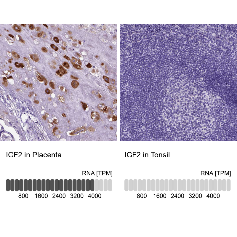 Anti-IGF2 Antibody