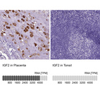 Anti-IGF2 Antibody