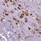 Immunohistochemical staining of human placenta shows moderate cytoplasmic positivity in extravillous trophoblastic cells.