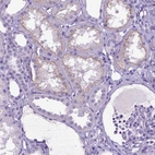 Immunohistochemical staining of human kidney shows weak cytoplasmic positivity in cells in tubules.