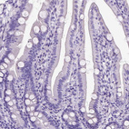 Immunohistochemical staining of human duodenum shows no positivity in glandular cells as expected.