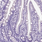Immunohistochemical staining of human duodenum shows no positivity in glandular cells as expected.
