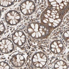Immunohistochemical staining of human rectum shows strong cytoplasmic positivity in glandular cells.
