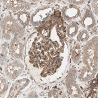 Immunohistochemical staining of human kidney shows strong cytoplasmic positivity in cells in glomeruli.