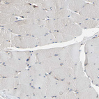 Immunohistochemical staining of human skeletal muscle shows no cytoplasmic positivity in myocytes as expected.