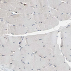 Immunohistochemical staining of human skeletal muscle shows no cytoplasmic positivity in myocytes as expected.
