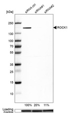 Western blot analysis in U-138MG cells transfected with control siRNA, target specific siRNA probe #1 and #2, using Anti-ROCK1 antibody. Remaining relative intensity is presented. Loading control: Anti-GAPDH.