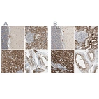 Anti-ACAT1 Antibody