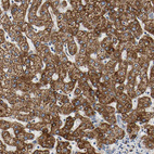 Immunohistochemical staining of human liver shows strong positivity in mitochondria in hepatocytes.