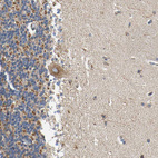 Immunohistochemical staining of human cerebellum shows moderate positivity in mitochondria in Purkinje cells.