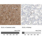 Anti-GLUL Antibody