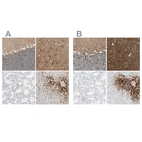 Immunohistochemical staining of human cerebellum, cerebral cortex, kidney and liver using Anti-GLUL antibody HPA007571 (A) shows similar protein distribution across tissues to independent antibody HPA007316 (B).