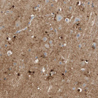 Immunohistochemical staining of human cerebral cortex shows strong cytoplasmic positivity in glial cells.