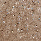 Anti-GLUL Antibody