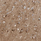 Immunohistochemical staining of human cerebral cortex shows strong cytoplasmic positivity in glial cells.