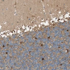 Immunohistochemical staining of human cerebellum shows strong cytoplasmic positivity in glial cells.