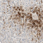 Immunohistochemical staining of human liver shows strong cytoplasmic positivity in hepatocytes.
