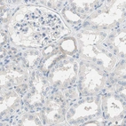 Immunohistochemical staining of human kidney shows only very weak cytoplasmic positivity in a subset of cells in tubules.