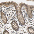 Immunohistochemical staining of human gastrointestinal shows moderate cytoplasmic positivity in glandular cells.
