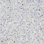 Immunohistochemical staining of human liver shows no positivity in hepatocytes as expected.