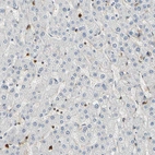 Immunohistochemical staining of human liver shows no positivity in hepatocytes as expected.