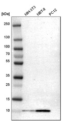 Anti-S100A6 Antibody