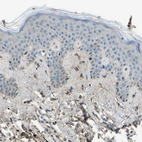 Immunohistochemical staining of human skin shows weak to moderate cytoplasmic positivity in fibroblasts.