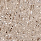 Anti-HECW1 Antibody