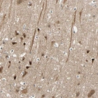 Anti-HECW1 Antibody