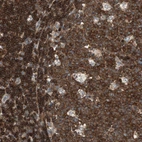 Immunohistochemical staining of human lymph node shows high expression.