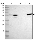Lane 1: Marker [kDa] 230, 130, 95, 72, 56, 36, 28, 17, 11_br/_Lane 2: Human cell line RT-4_br/_Lane 3: Human cell line U-251MG sp_br/_Lane 4: Human plasma (IgG/HSA depleted)_br/_Lane 5: Human liver tissue_br/_Lane 6: Human tonsil tissue