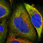 Immunofluorescent staining of human cell line A-431 shows localization to plasma membrane & cytosol.