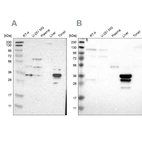 Western blot analysis using Anti-PHYH antibody HPA007598 (A) shows similar pattern to independent antibody HPA011796 (B).