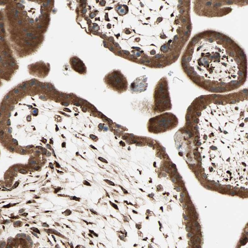 Anti-P4HA1 Antibody