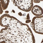 Anti-P4HA1 Antibody