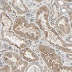 Immunohistochemical staining of human kidney shows weak granular cytoplasmic positivity in cells in tubules.