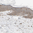 Immunohistochemical staining of human skin shows weak granular cytoplasmic positivity in squamous epithelial cells.