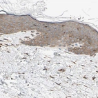 Immunohistochemical staining of human skin shows weak granular cytoplasmic positivity in squamous epithelial cells.