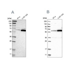 Western blot analysis using Anti-P4HA1 antibody HPA007599 (A) shows similar pattern to independent antibody HPA026593 (B).