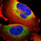 Immunofluorescent staining of human cell line U-251 MG shows localization to endoplasmic reticulum.