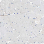 Immunohistochemical staining of human skeletal muscle shows no positivity in myocytes as expected.