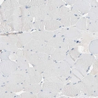 Immunohistochemical staining of human skeletal muscle shows no positivity in myocytes as expected.