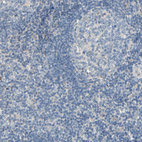 Immunohistochemical staining of human tonsil shows no positivity in lymphoid cells as expected.