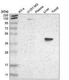 Western blot analysis in human cell line RT-4, human cell line U-251 MG, human plasma, human liver tissue and human tonsil tissue.