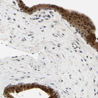 Anti-RIOX2 Antibody